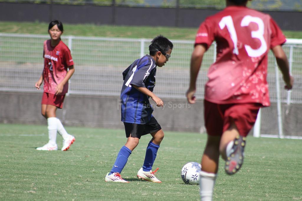 山田 ー 広島 ②【デンタルカップ】